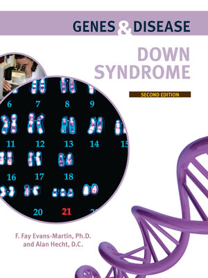 cover image of Down Syndrome